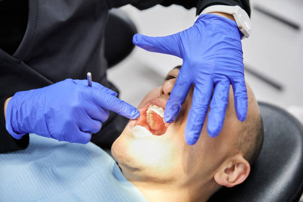 Best Broken or Chipped Tooth Repair in King City, OR
